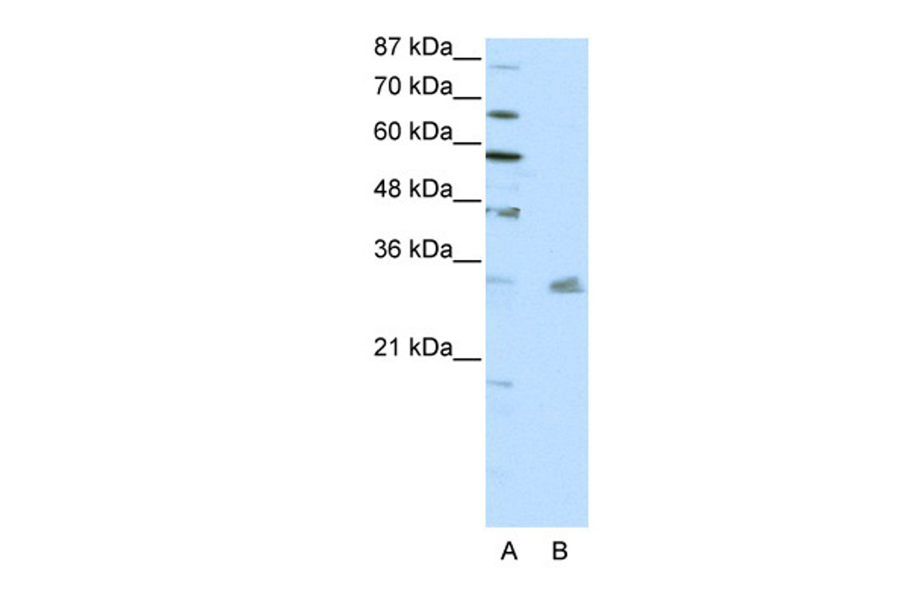 Antibody used in WB on Human HepG2 at 0.2-1 ug/ml.