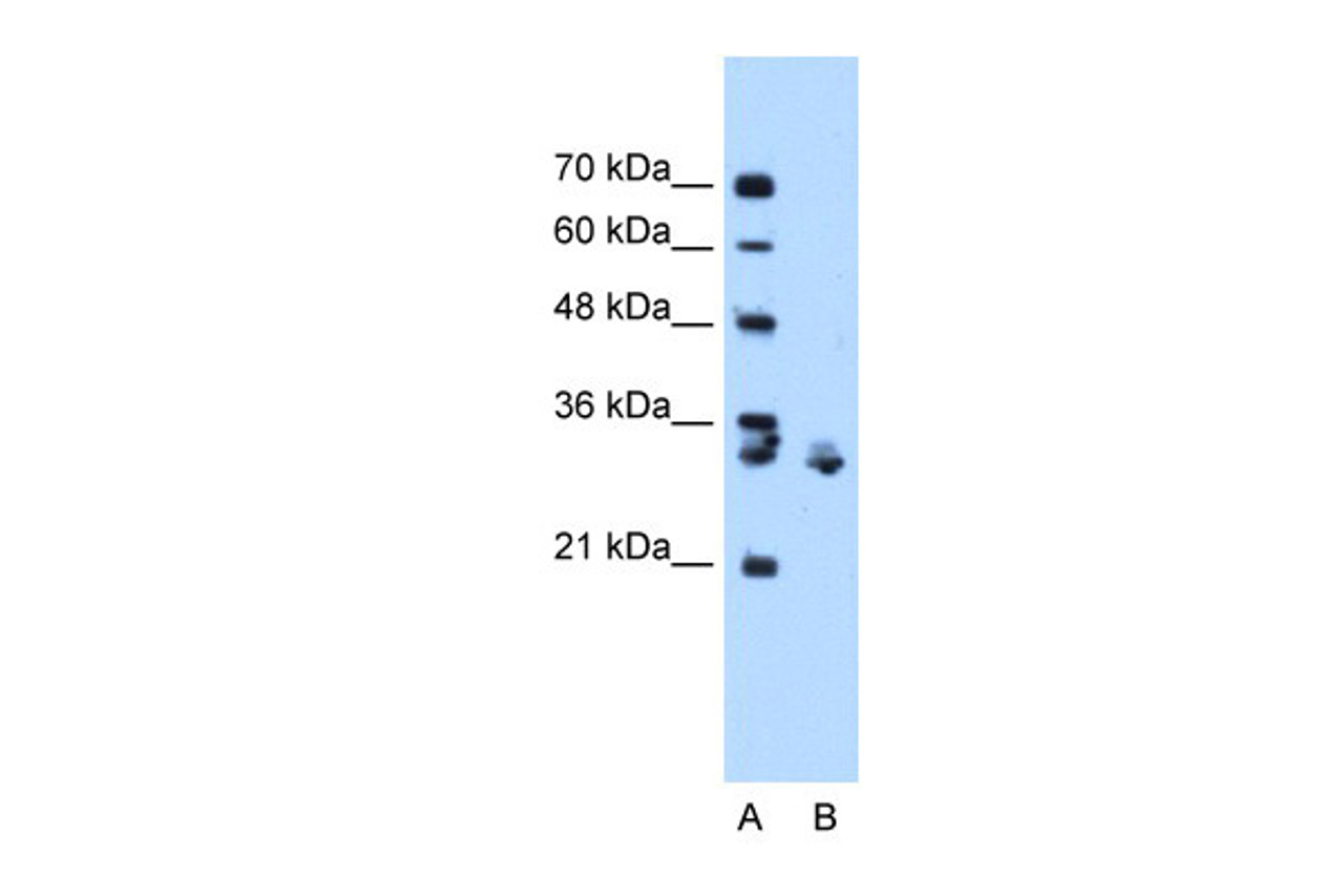 Antibody used in WB on Human Jurkat 0.2-1 ug/ml.