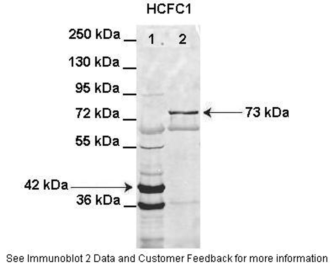 Antibody used in WB on transformed bacteria at: 1:1000 (Lane1: HIS-HCFC1 16-363aa (42kD) transformed bacteria lysate, Lane2: GFP-HCFC1 363-2002aa (73kD) transformed bacteria lysate elution sample) .