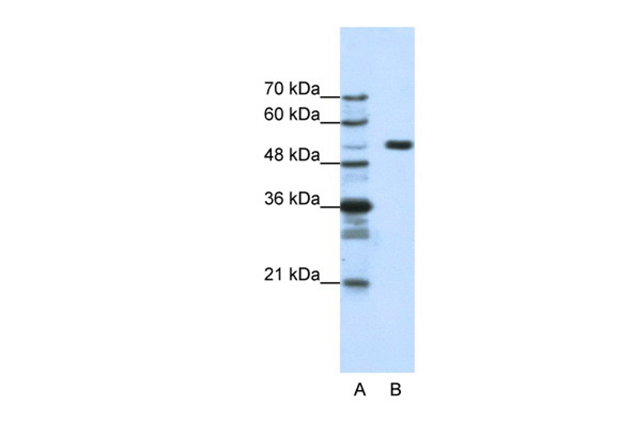 Antibody used in WB on Human HepG2 cells at 1.25 ug/ml.