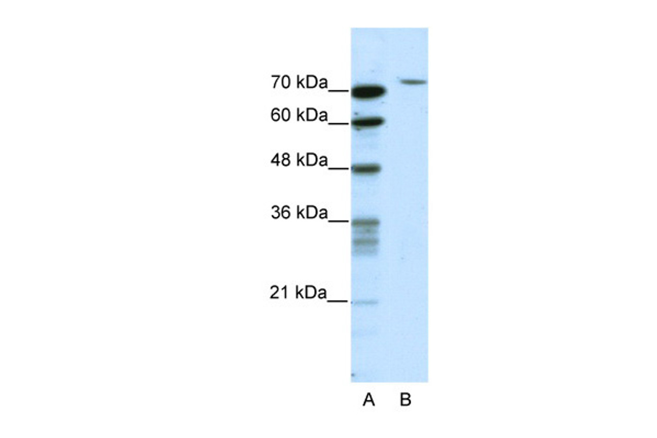 Antibody used in WB on Human HepG2 at 2.5 ug/ml.