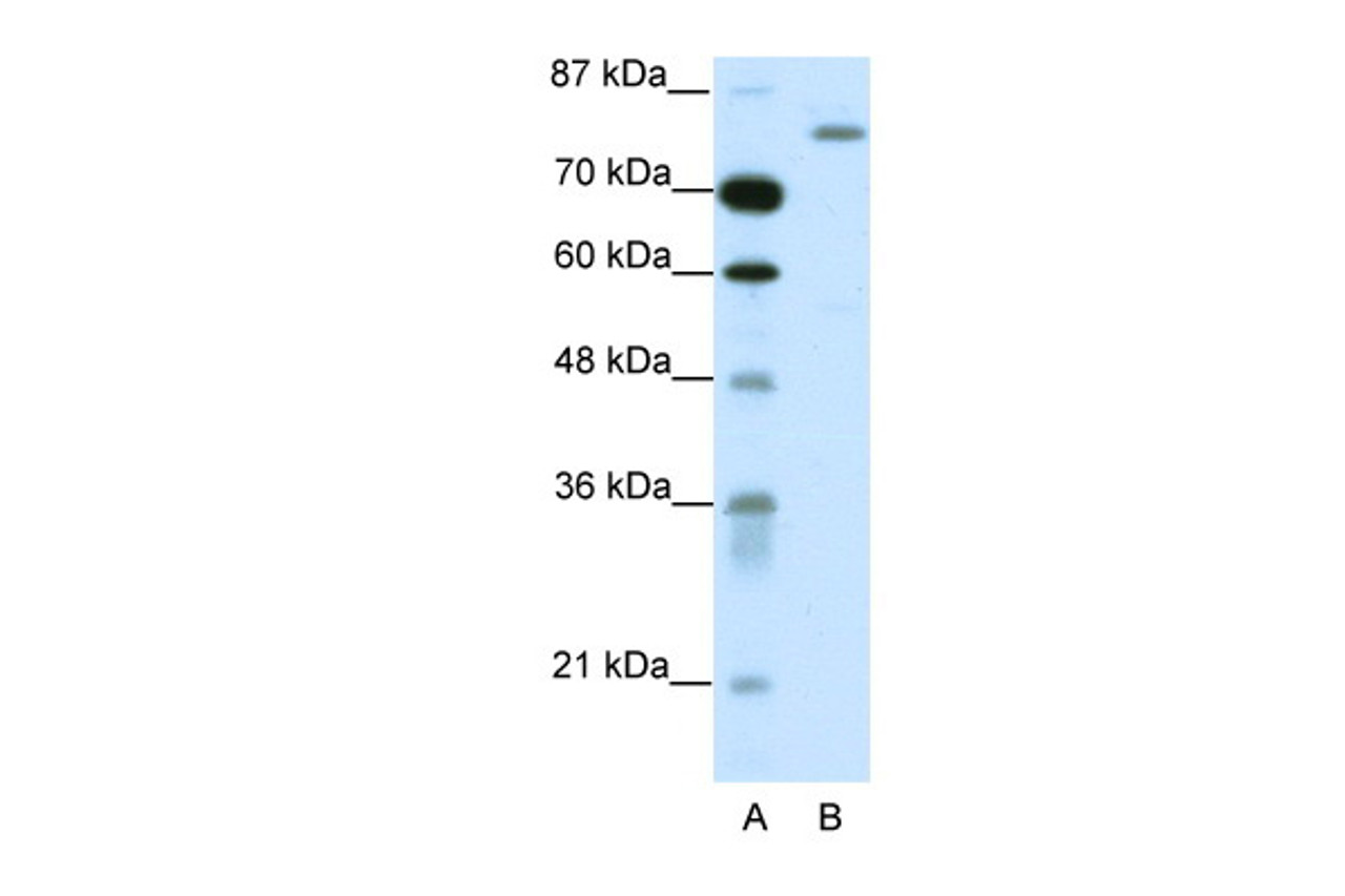 Antibody used in WB on Human HepG2 at 1.25 ug/ml.