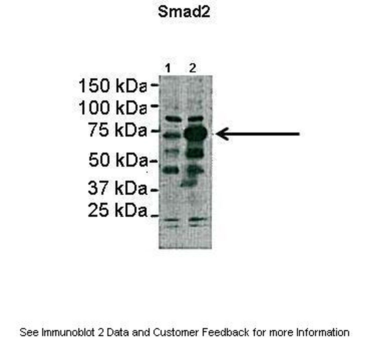 Antibody used in WB on transfected HEK-293 at: 1:1000 (Lane1: 2ug HEK293lysate, Lane2: 2ug SMAD2 transfected HEK293 lysate) .