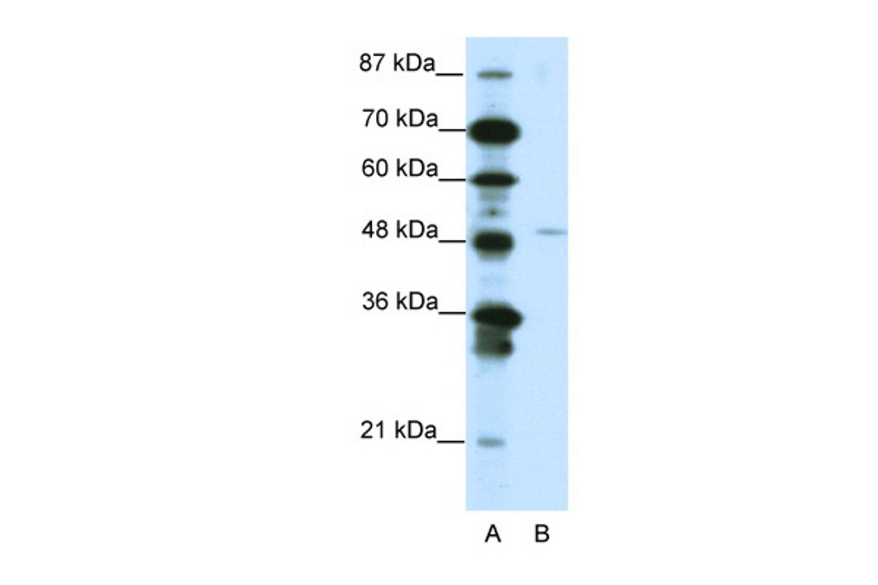 Antibody used in WB on Human Jurkat 1.25 ug/ml.