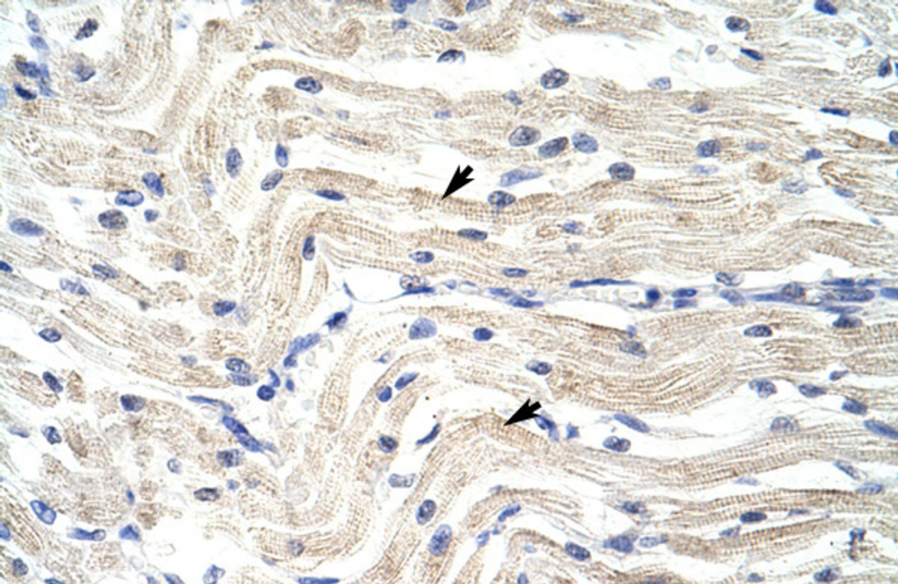 Antibody used in IHC on Human Muscle.