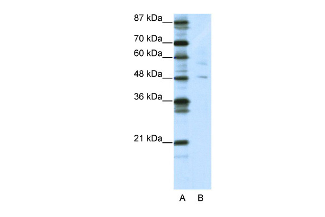 Antibody used in WB on Human HEK293T cells at 5.0 ug/ml.