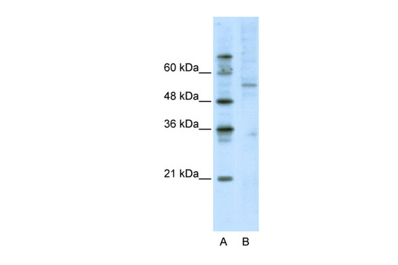 Antibody used in WB on Human Jurkat 2.5 ug/ml.