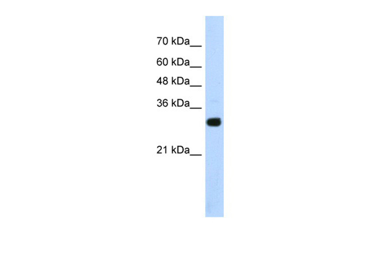 Antibody used in WB on Transfected 293T at 1.25 ug/ml.