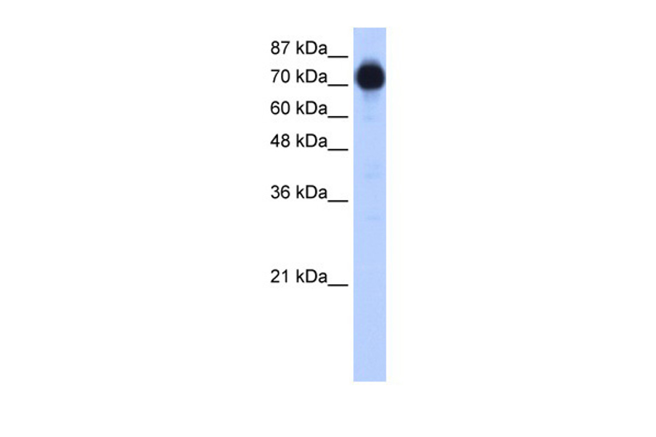 Antibody used in WB on Transfected 293T at 0.03 ug/ml.