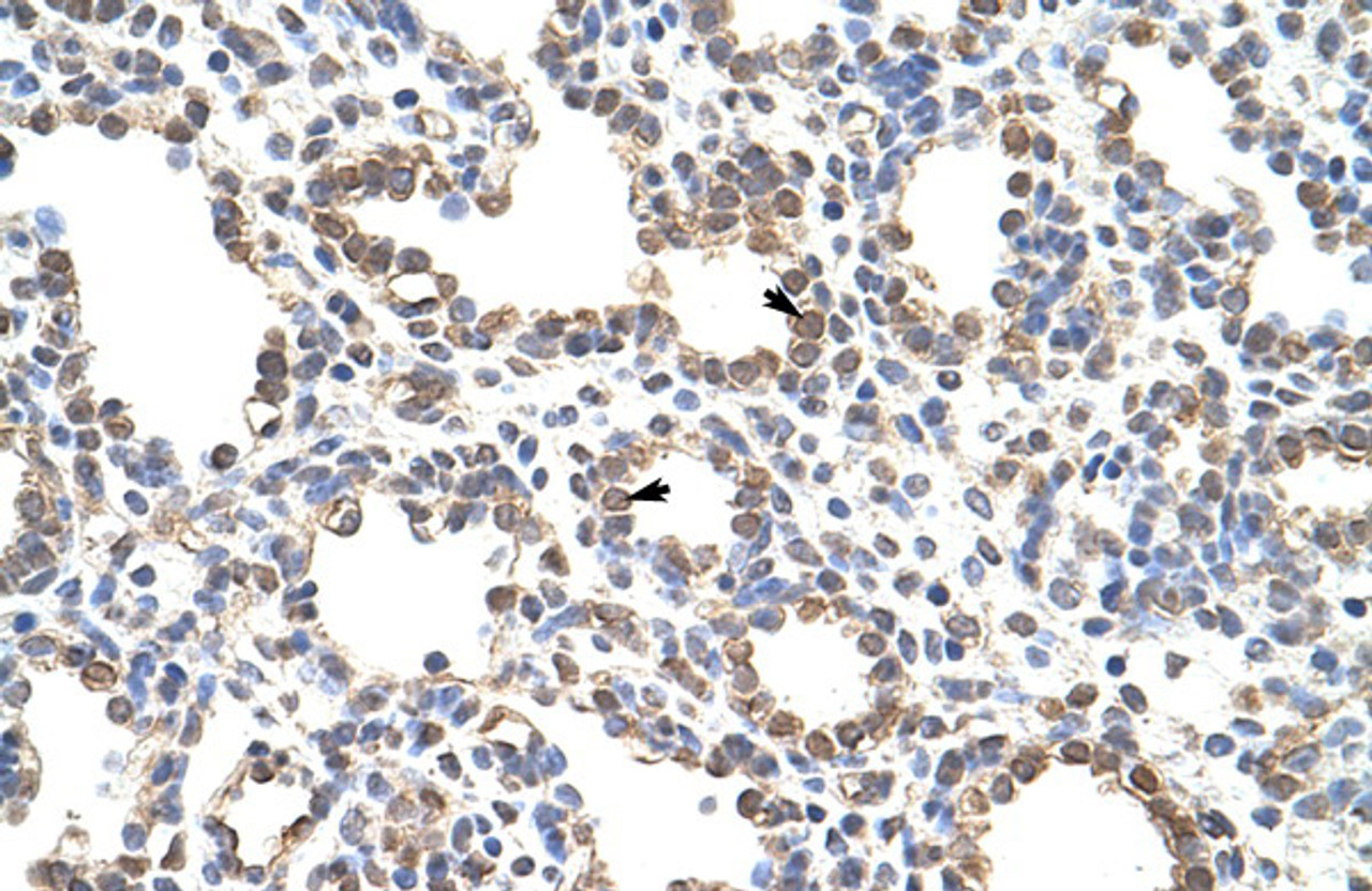 Antibody used in IHC on Human Lung.