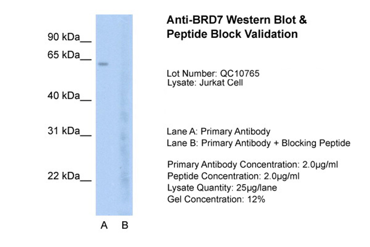 Antibody used in WB on Jurkat 2.5 ug/ml (Lane A: Primary Antibody and Lane B: Primary Antibody + Blocking Peptide ) .