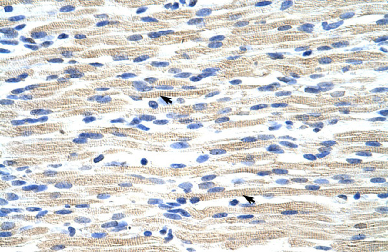 Antibody used in IHC on Human Muscle.