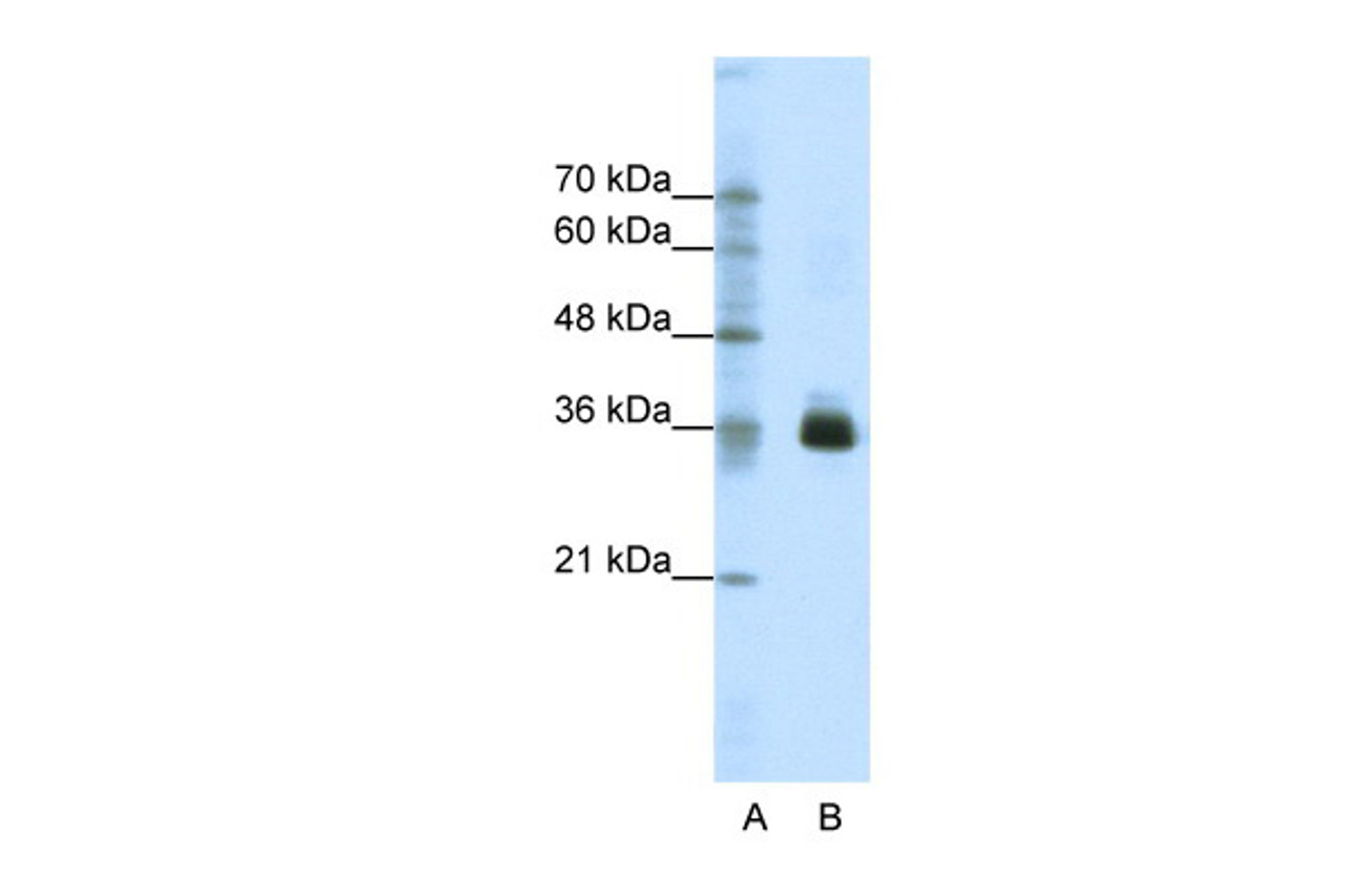 Antibody used in WB on Human Jurkat 1.25 ug/ml.