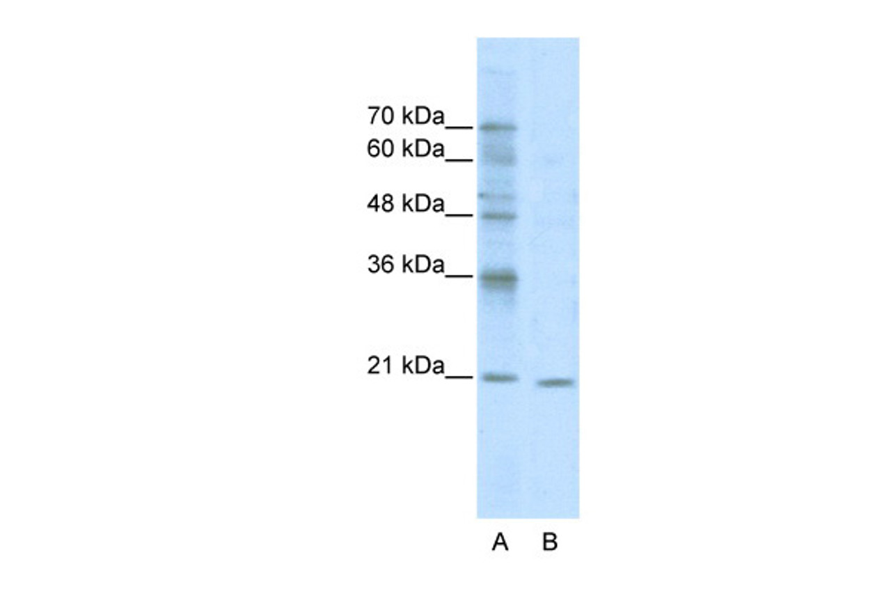 Antibody used in WB on Human Jurkat 5.0 ug/ml.