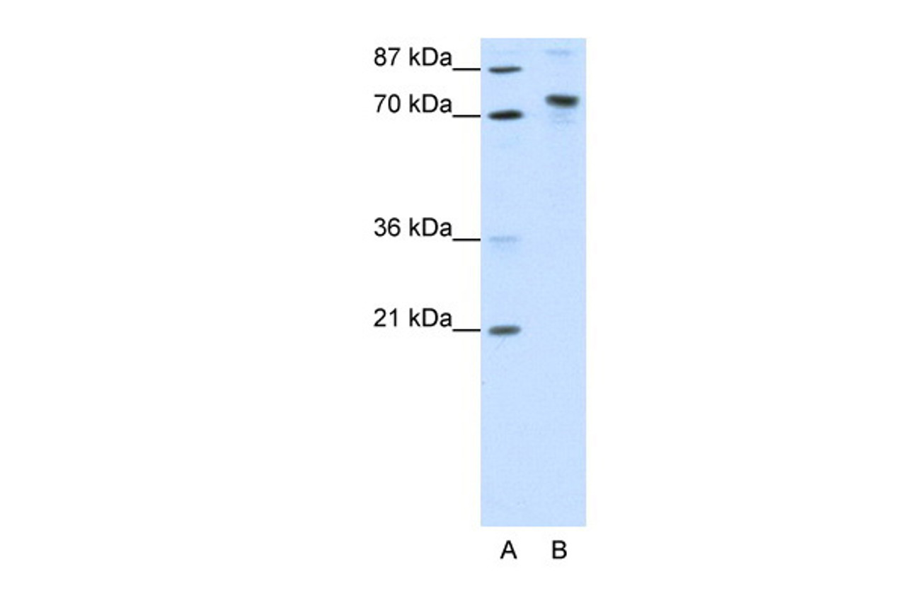 Antibody used in WB on Transfected 293T at 1.25 ug/ml.