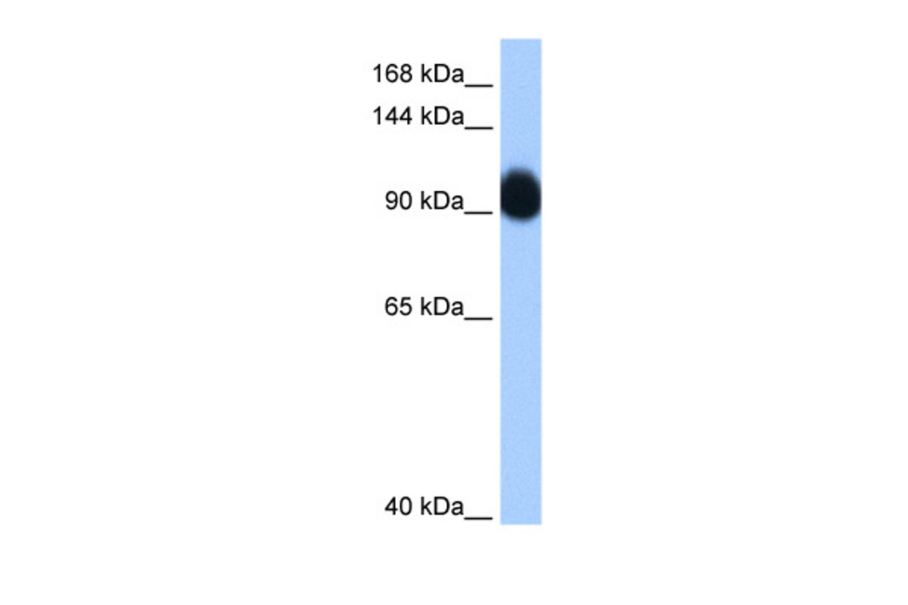 Antibody used in WB on Transfected 293T at 0.2-1 ug/ml.