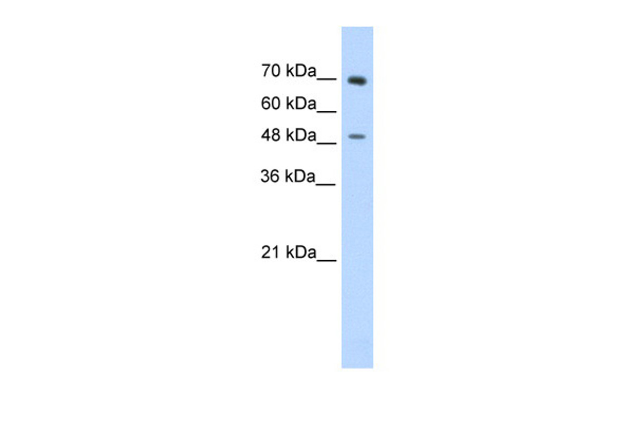 Antibody used in WB on Human Jurkat 0.2-1 ug/ml.