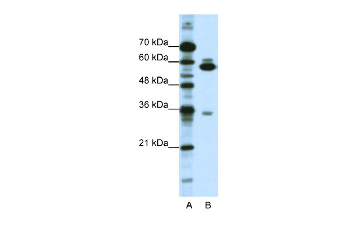 Antibody used in WB on Human HepG2 at 1.25 ug/ml.