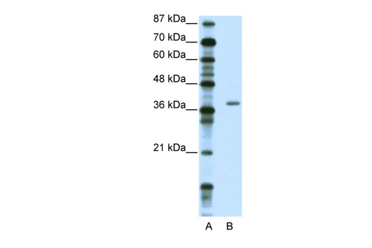 Antibody used in WB on Human Jurkat 2.5 ug/ml.