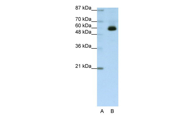 Antibody used in WB on Transfected 293T at 1.25 ug/ml.