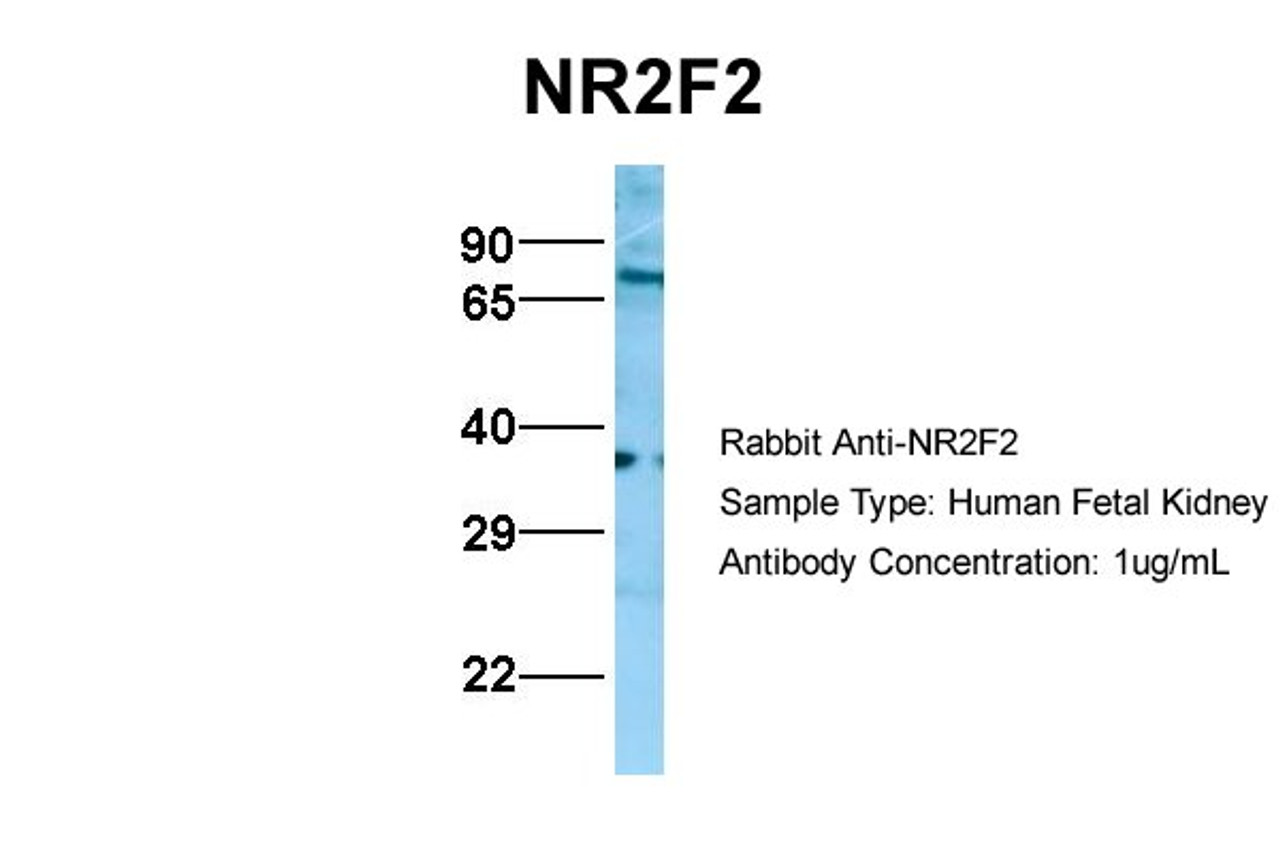 Antibody used in WB on Hum. Fetal Kidney at 1 ug/ml.