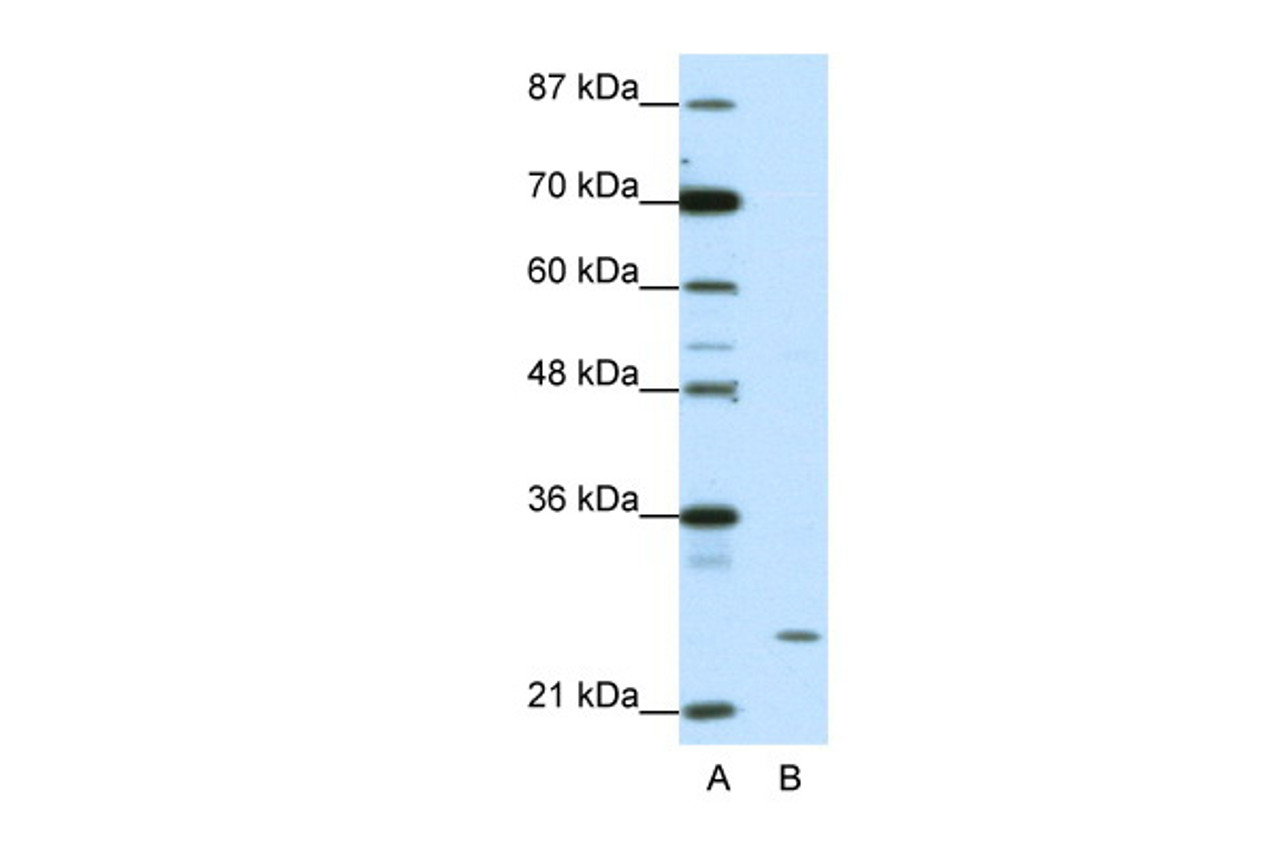 Antibody used in WB on Human HepG2 at 1.25 ug/ml.