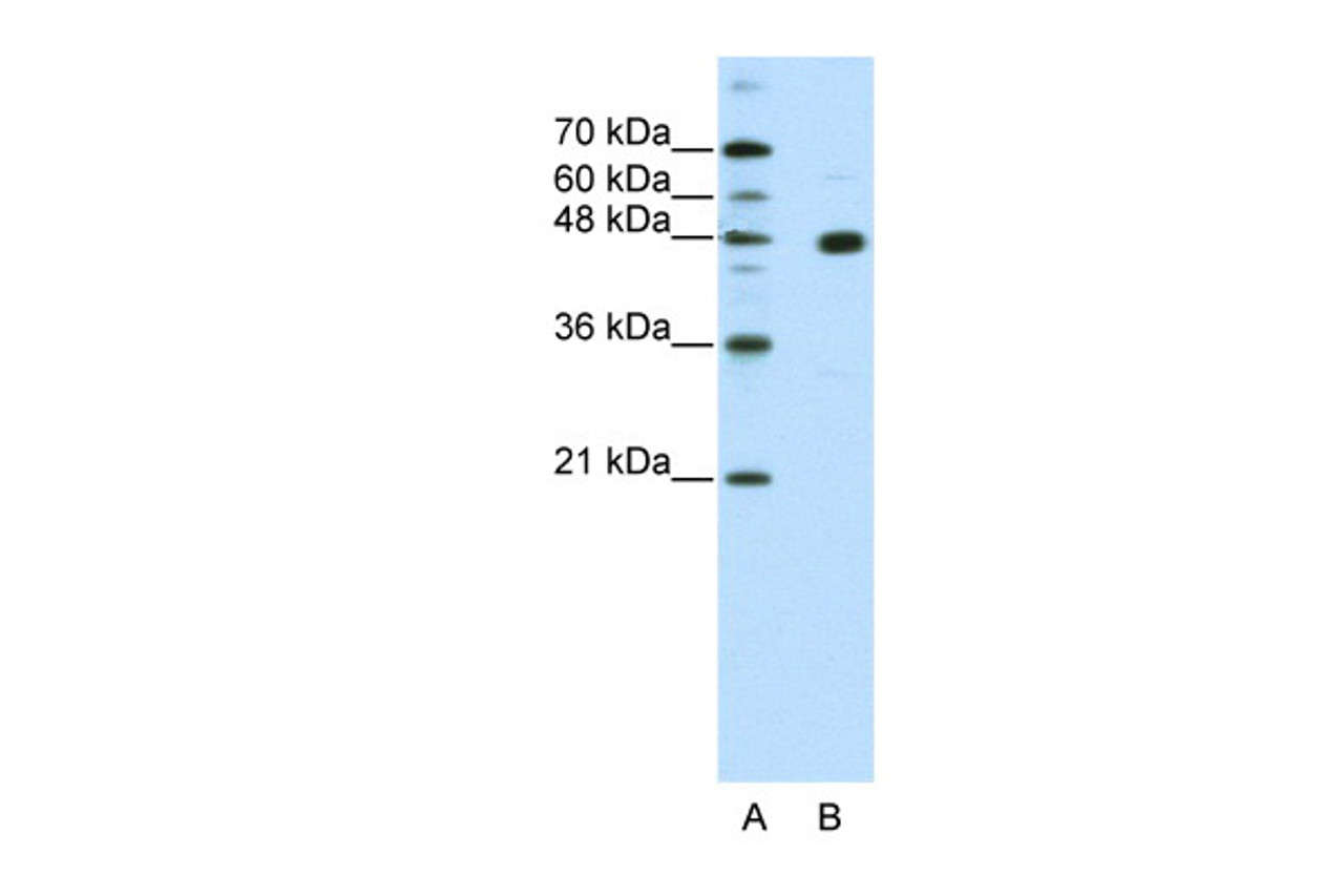 Antibody used in WB on Human HepG2 at 2.5 ug/ml.