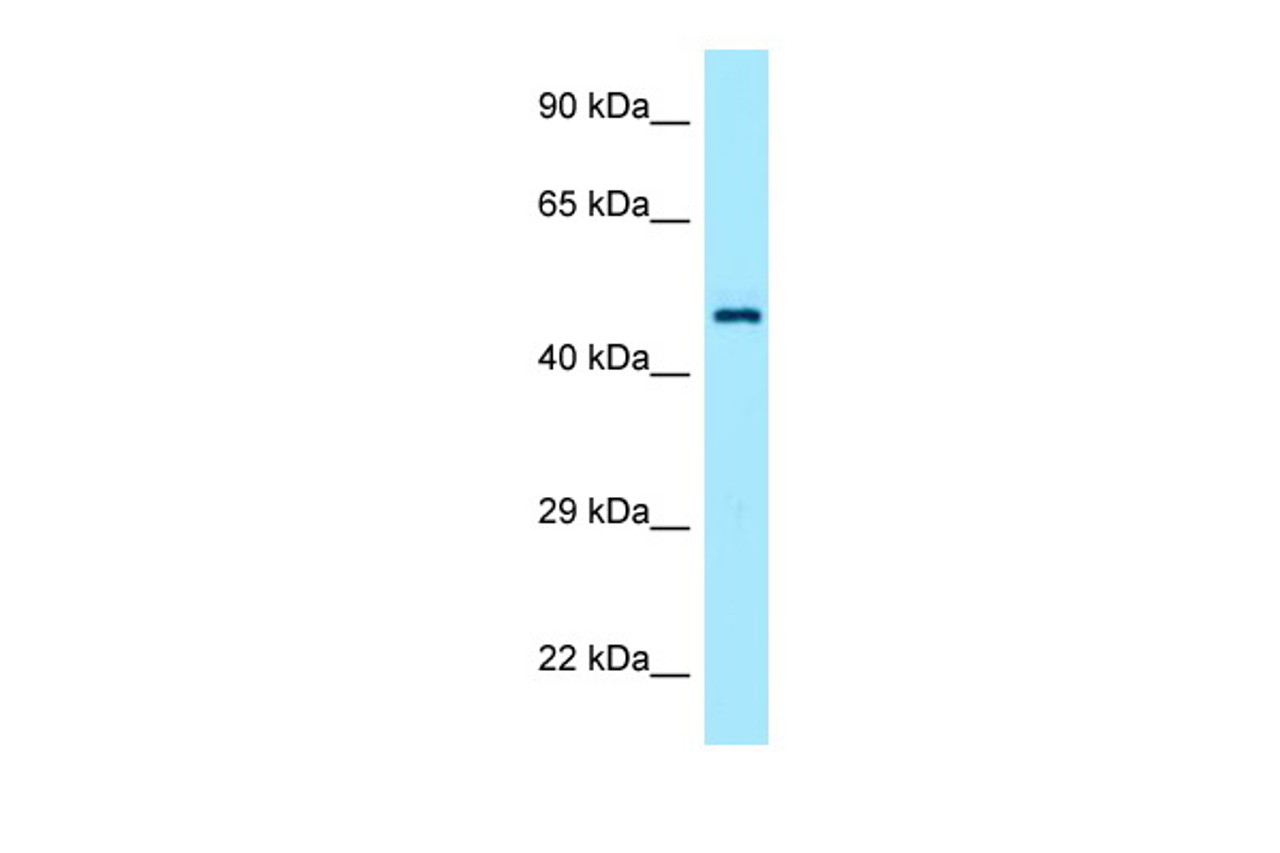 Antibody used in WB on Human Placenta at 1 ug/ml.