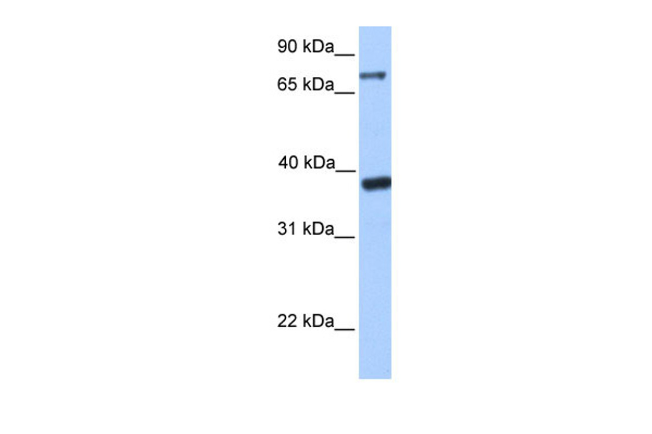 Antibody used in WB on Transfected 293T at 0.2-1 ug/ml.