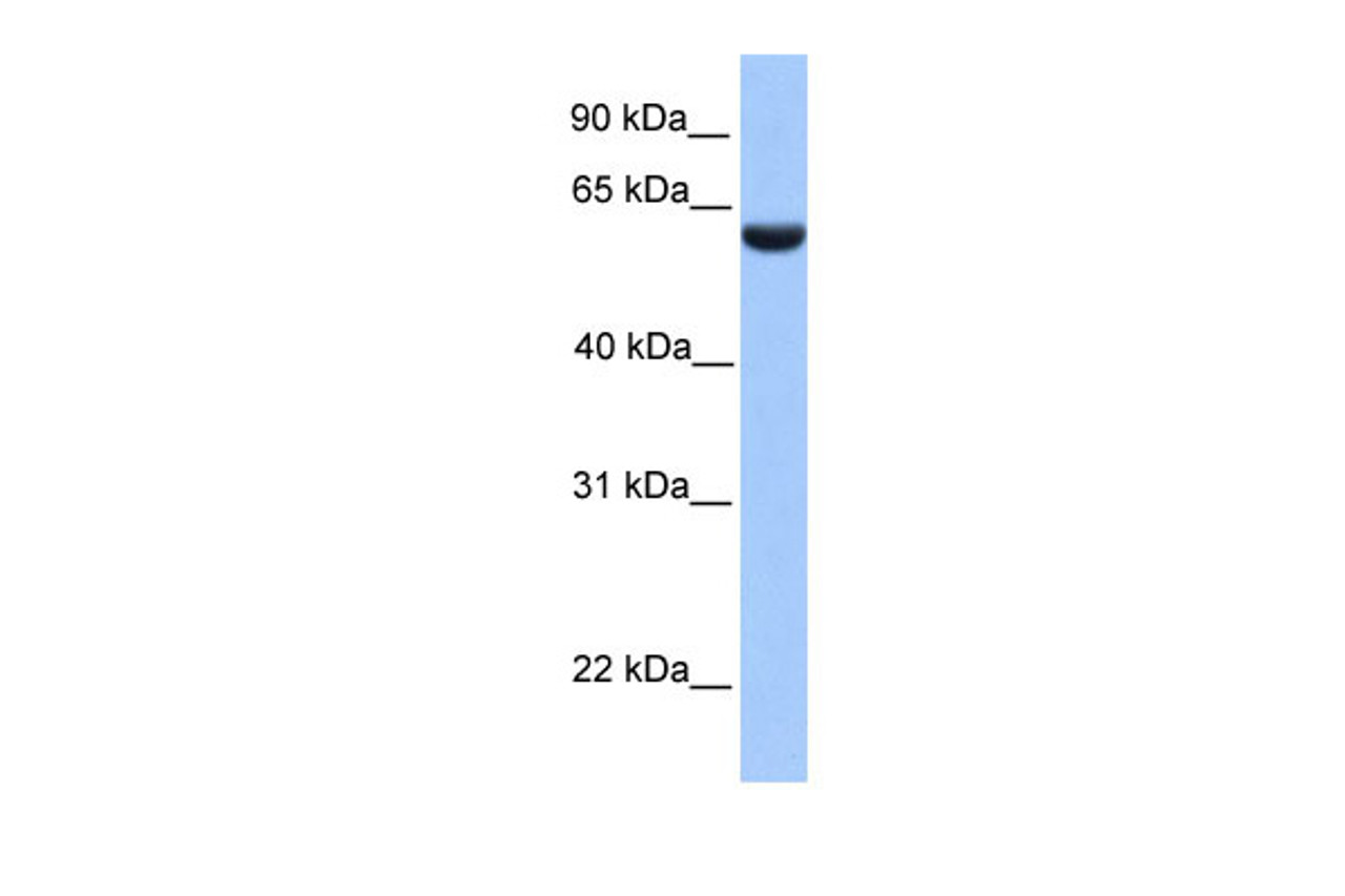 Antibody used in WB on Human HeLa at 0.2-1 ug/ml.