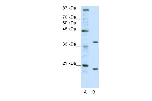 Antibody used in WB on Human HepG2 at 0.2-1 ug/ml.