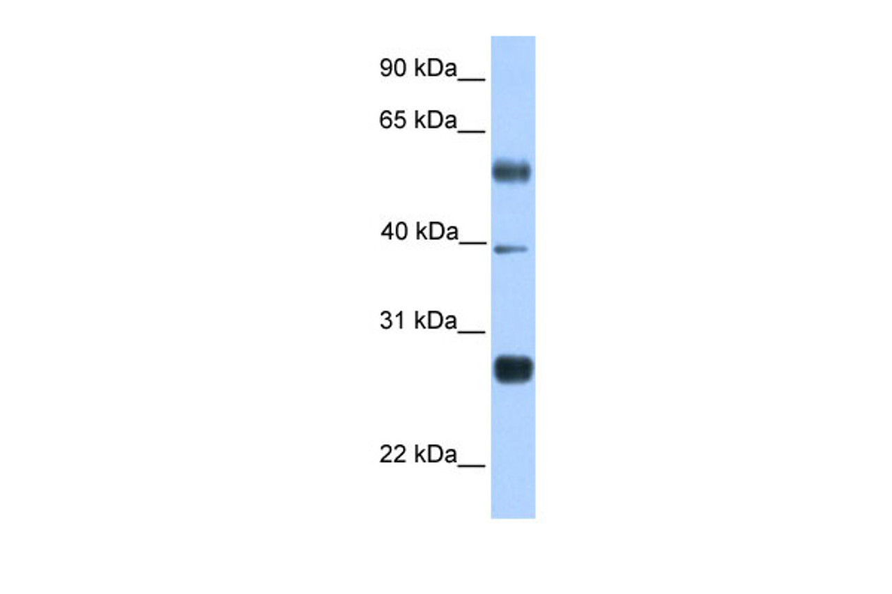 Antibody used in WB on Transfected 293T at 0.2-1 ug/ml.