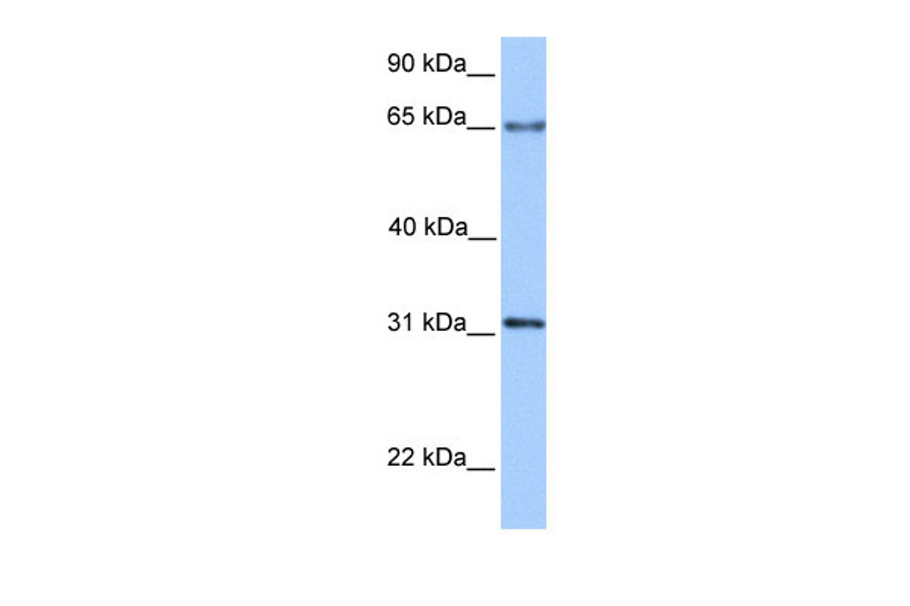 Antibody used in WB on Transfected 293T at 0.2-1 ug/ml.