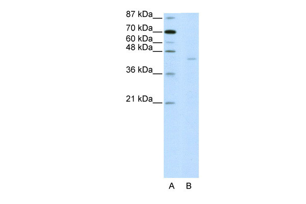 Antibody used in WB on Human HepG2 at 2.5 ug/ml.