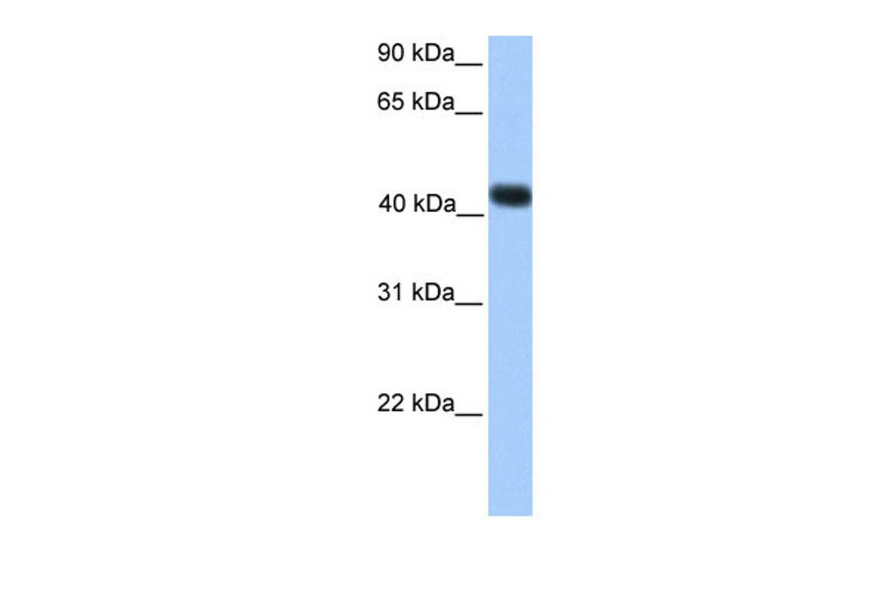 Antibody used in WB on Transfected 293T at 0.2-1 ug/ml.