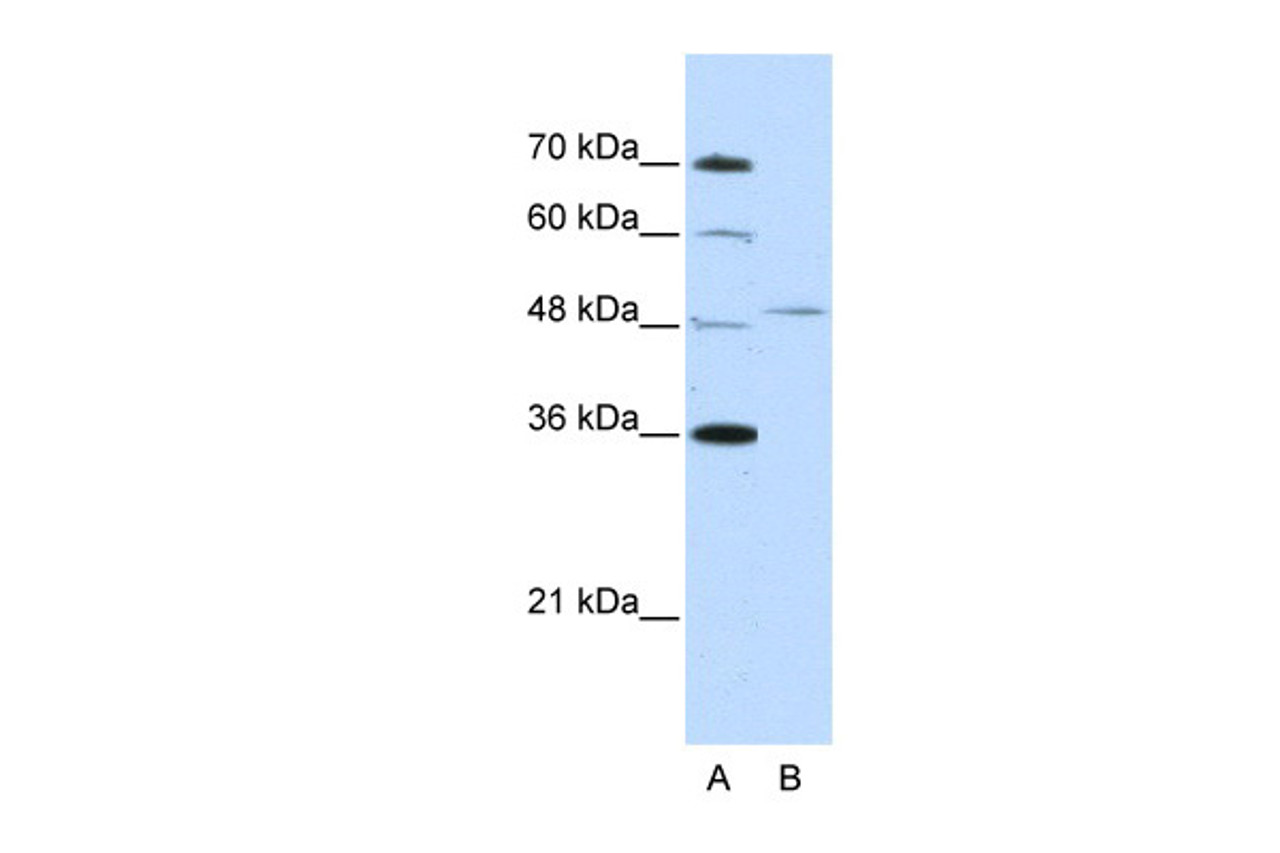 Antibody used in WB on Human Jurkat 2.5 ug/ml.