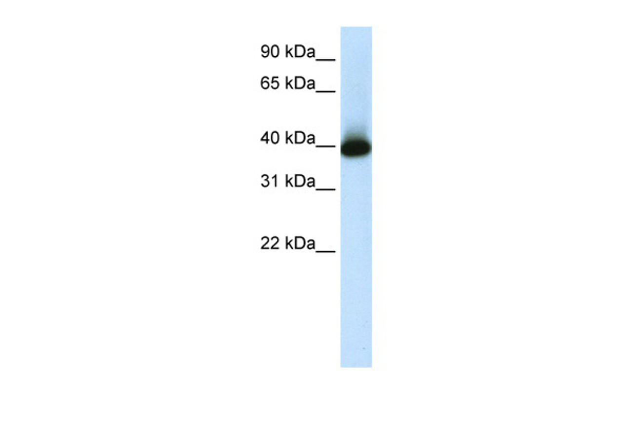 Antibody used in WB on Human LN18 at 1.25 ug/ml.