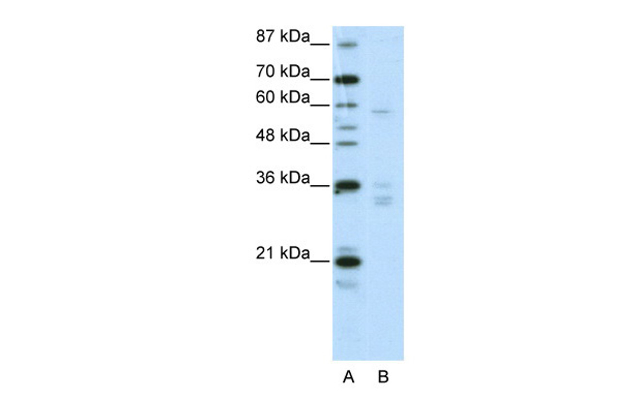 Antibody used in WB on Human HepG2 at 2.5 ug/ml.