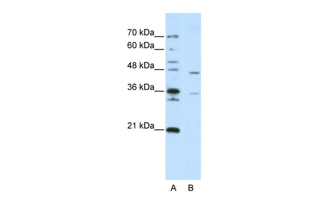 Antibody used in WB on Human Jurkat 2.5 ug/ml.