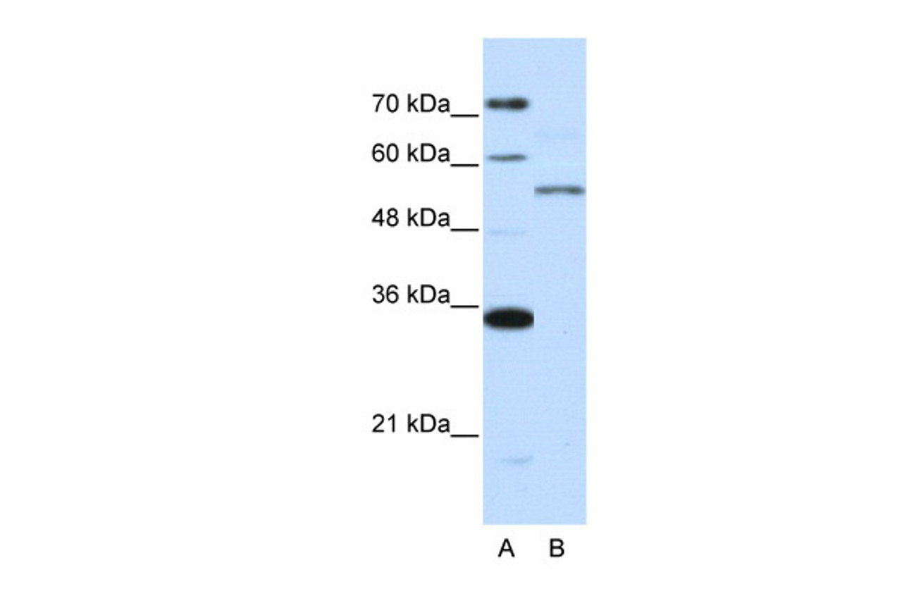 Antibody used in WB on Human Jurkat 0.2-1 ug/ml.