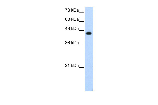Antibody used in WB on Transfected 293T at 1.25 ug/ml.