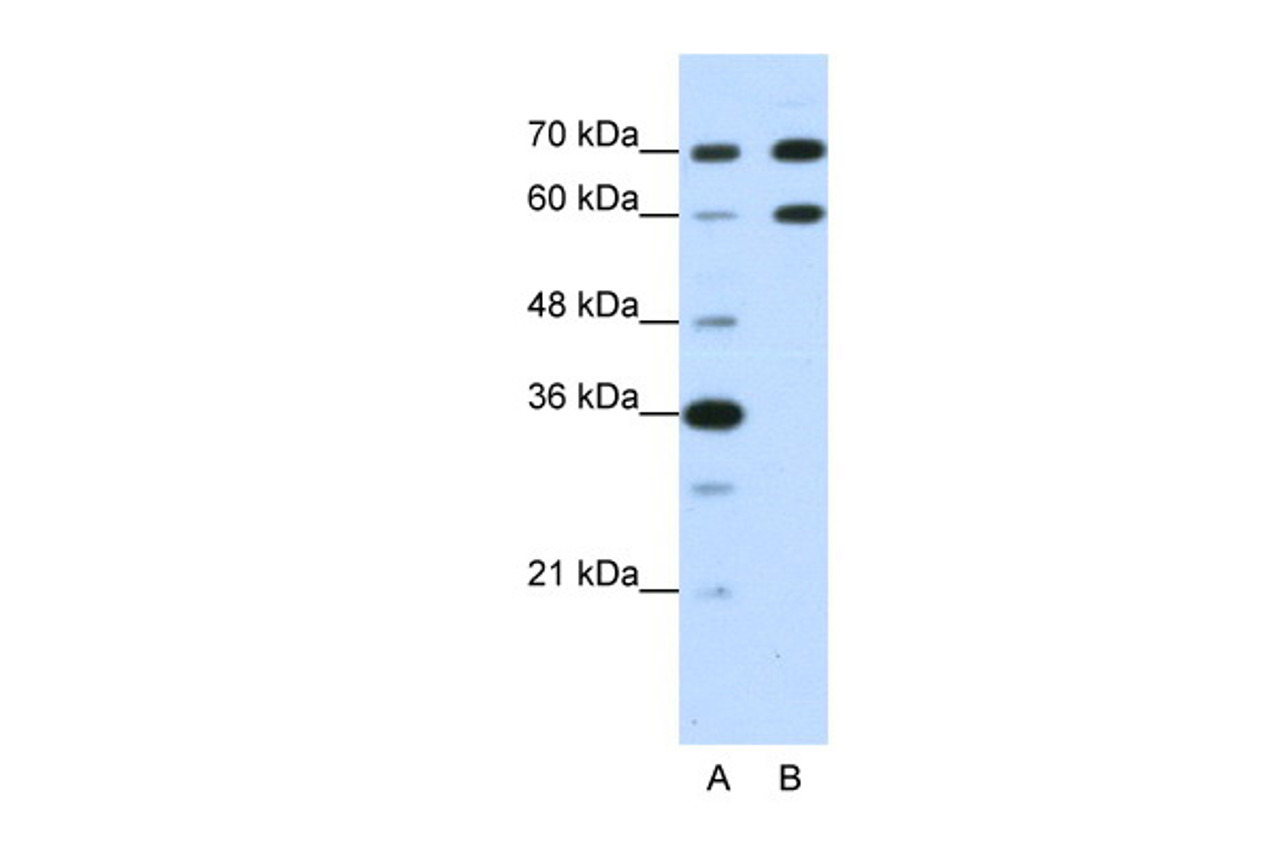 Antibody used in WB on Human HepG2 at 1.25 ug/ml.