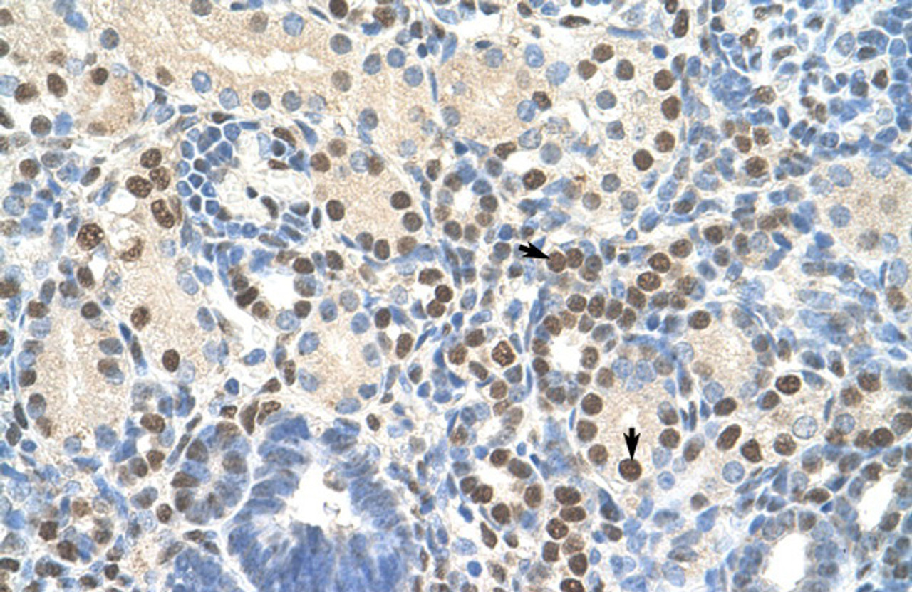 Antibody used in IHC on Human kidney.