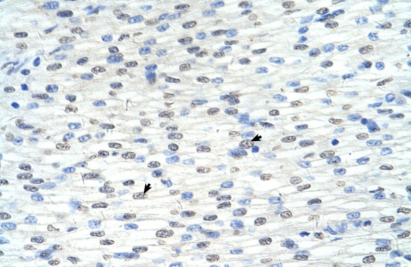 Antibody used in IHC on Human Heart.