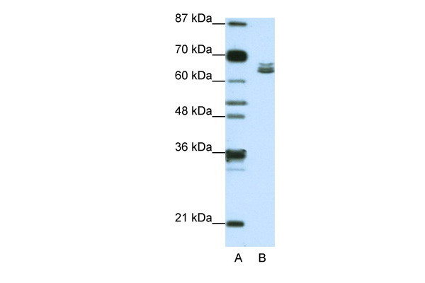 Antibody used in WB on Human Jurkat 1.25 ug/ml.