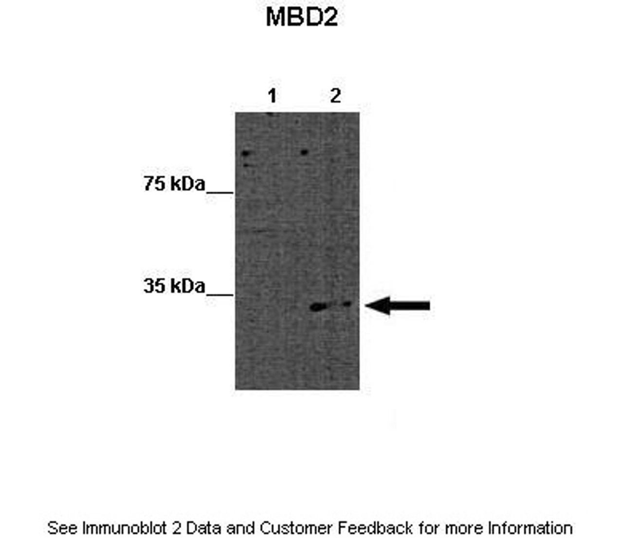Antibody used in WB on Mouse ES at: 1:1000 (Lane 1: 15ug WT mouse ES lysate, Lane 2: 15ug MBD2 KO mouse ES lysate) .