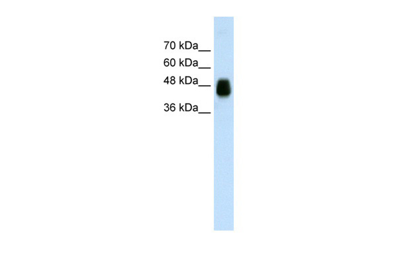 Antibody used in WB on Transfected 293T at 0.0156 ug/ml.
