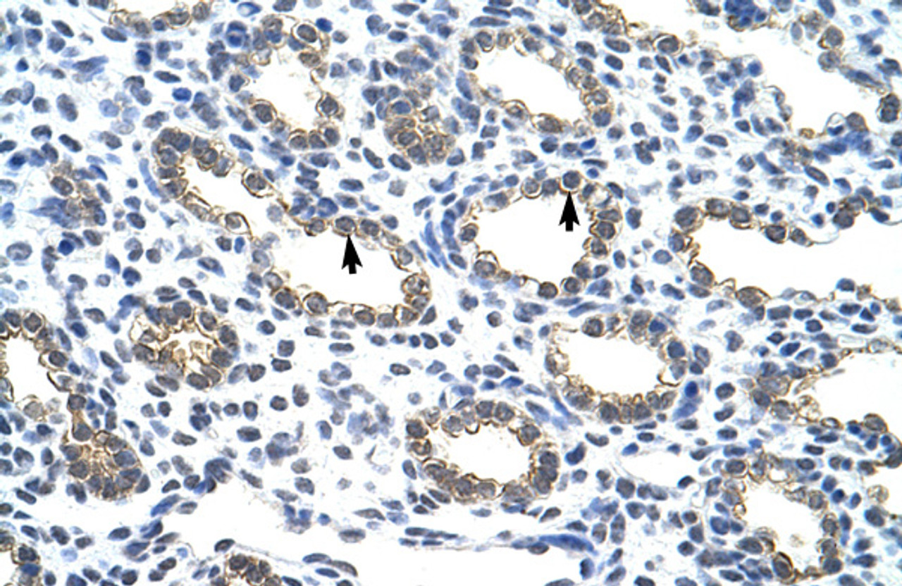 Antibody used in IHC on Human Lung at 4.0-8.0 ug/ml.