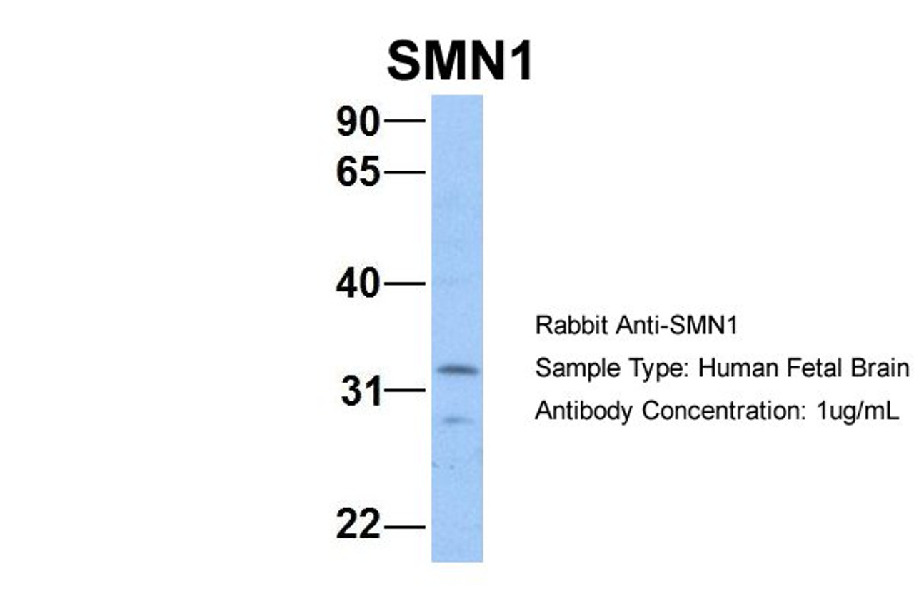 Antibody used in WB on Hum. Fetal Brain at 1 ug/ml.