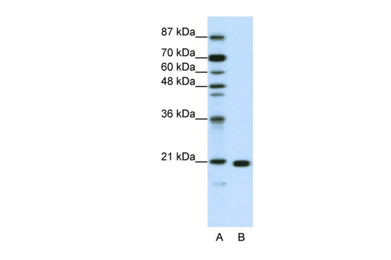 Antibody used in WB on Human Jurkat 1.25 ug/ml.